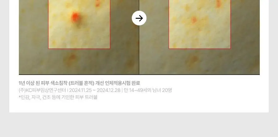 [5월올영픽/포켓몬 에디션] 닥터지 레드블레미쉬 클리어 히알 시카 수딩 세럼 50ml 기획 (리필50ml+꼬부기파우치) 상세페이지 38